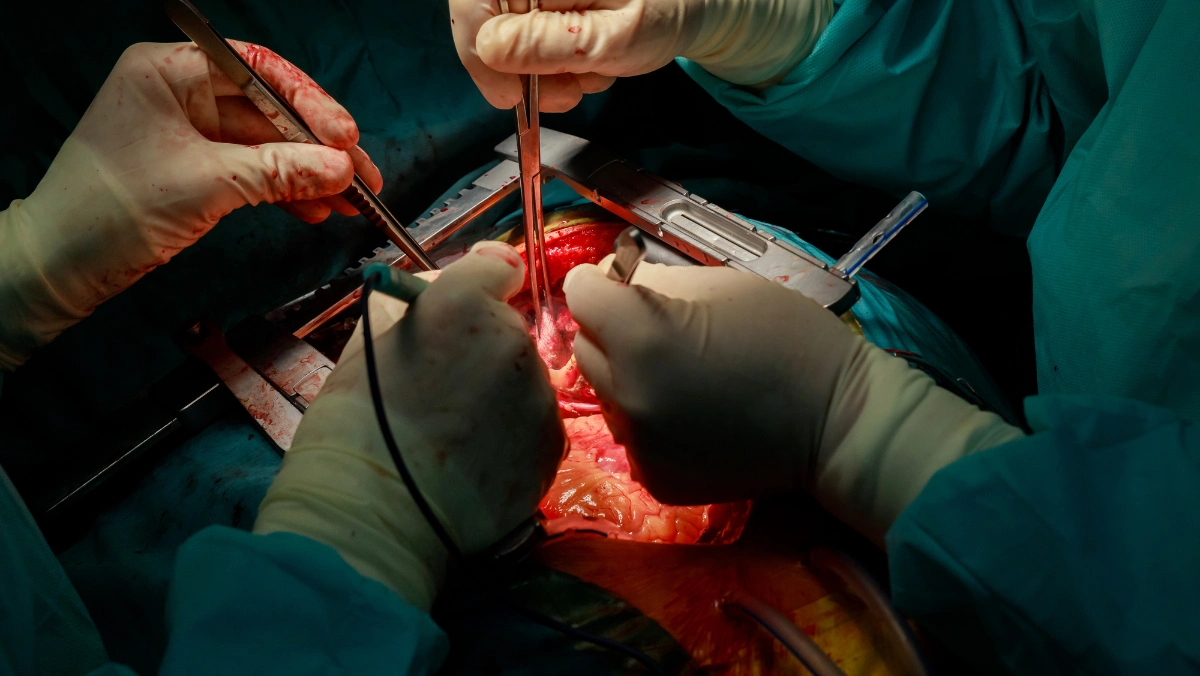 coronary Angioplasty and Stenting