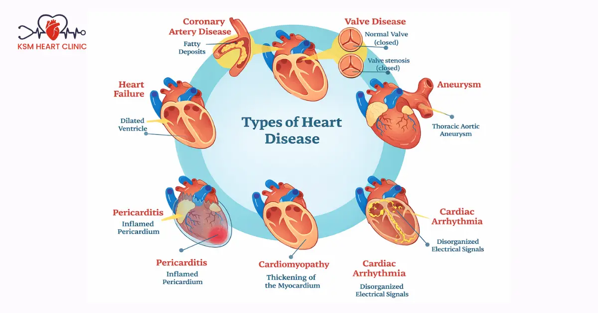 Best Cardiologist in Chennai