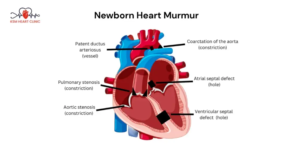 Newborn Heart Murmur